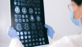 Impacto cognitivo da Covid-19 pode envelhecer cérebro em 10 anos