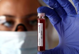 Alagoas registra no total 1.527 óbitos pela covid-19