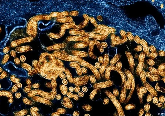 OMS confirma primeira recuperação de paciente no atual surto de ebola no Congo