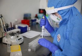Anvisa autoriza testes da vacina contra a covid-19 da Johnson & Johnson