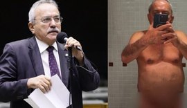 Ex-deputado de 79 anos publica nudes nas redes sociais