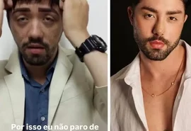 Rico Melquíades surpreende com fotos de antes e depois de cirurgias