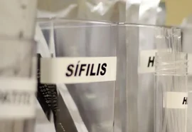 SUS passa a adotar antibiótico para prevenir sífilis e clamídia