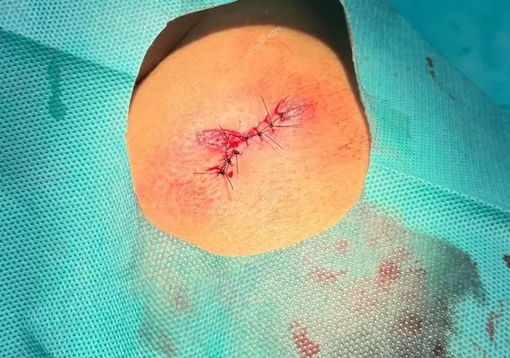 Torcedora do CSA afirma ter sido atingida por bala de borracha no Rei Pelé