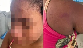 Caso de tortura contra doméstica grávida choca o Maranhão
