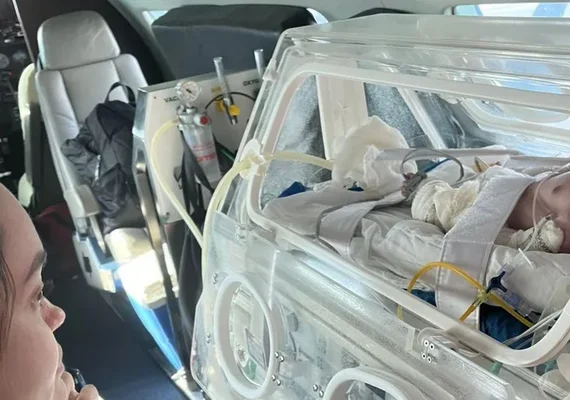 Bebês cardiopatas de Maceió são transferidos para cirurgia em São Paulo
