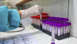 Covid-19: Alagoas registra 90.384 casos e 2.221 óbitos