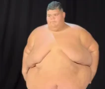 Gordão da XJ mostra antes e depois após perder 130 kg