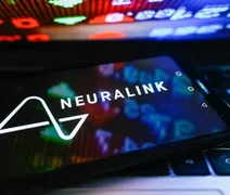 Neuralink: o que você precisa saber sobre o implante cerebral