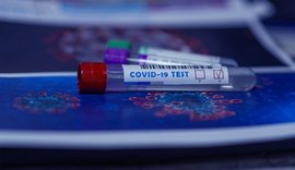 Brasil passa de 2,2 milhões de pessoas infectadas com o novo coronavírus