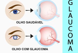 No mês do combate ao Glaucoma, população terá atendimento gratuito