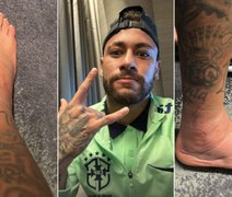Polêmico, Neymar mostra fotos de seu tornozelo inchado; veja
