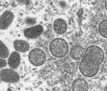 Saúde monitora sete casos suspeitos de varíola dos macacos no Brasil