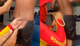 Adolescente é atingido por arpão durante pesca subaquática na Praia do Francês