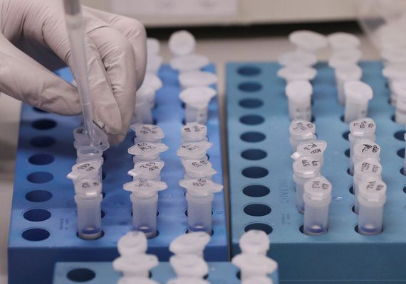 Alagoas tem 45 casos confirmados da Covid-19 e permanece com 3 óbitos