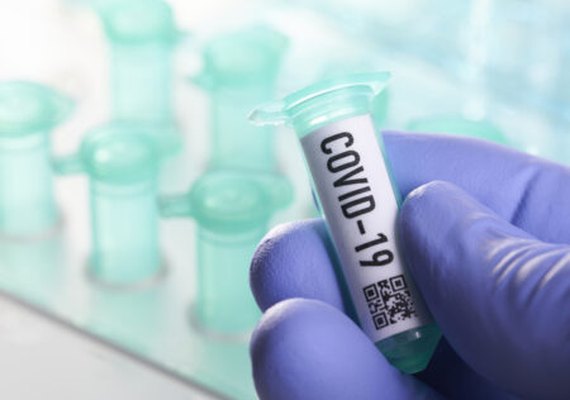 Alagoas registra o total de 1.281 óbitos pela covid-19
