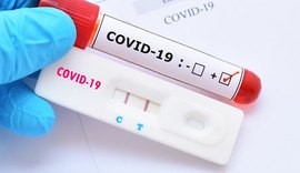 Procon Arapiraca realiza pesquisa para testes de Covid-19