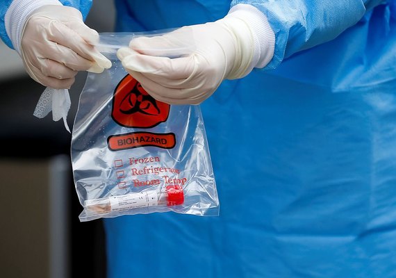 Covid-19: 500 mil kits de teste rápido chegam ao Brasil