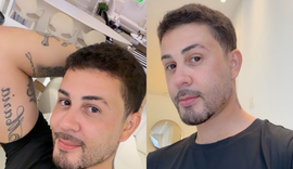 Carlinhos Maia revela cirurgia estética após sumiço das redes; confira