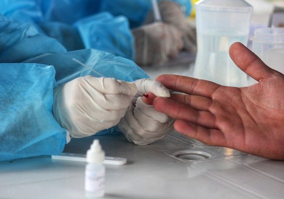 Planos de saúde incluirão mais 6 exames na lista obrigatória