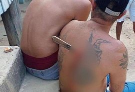 Homem esfaqueado após discussão fica com faca cravada nas costas