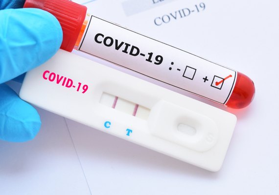 Alagoas passa de 40 mil casos confirmados da Covid-19