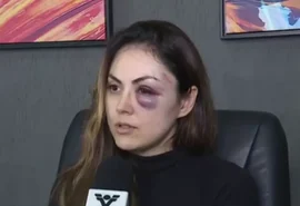 'Tinha medo dele, mas não imaginava violência', diz mulher espancada por colega