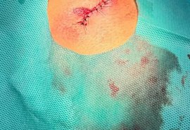 Torcedora do CSA afirma ter sido atingida por bala de borracha no Rei Pelé