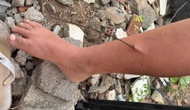Criança tem perna perfurada por vergalhão em terreno baldio de Arapiraca