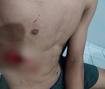 Mãe denuncia que filho de 16 anos foi torturado e roubado por PMs em Maceió