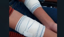 Estudantes ficam feridas após briga com estilete dentro de ônibus escolar em Arapiraca
