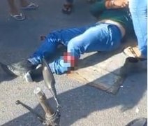 Motociclista sofre fratura exposta após colisão com caminhão em Rio Largo