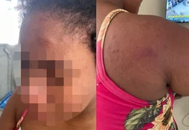 Caso de tortura contra doméstica grávida choca o Maranhão