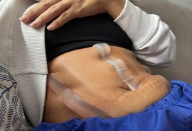 Mulheres que denunciaram cirurgião plástico terão casos analisados por perito