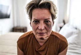 Joice Hasselmann: polícia do DF descarta agressão e diz que deputada caiu 'da própria altura'