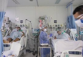 Neurologistas identificam derrame em pacientes com menos de 50 anos infectados por novo coronavírus