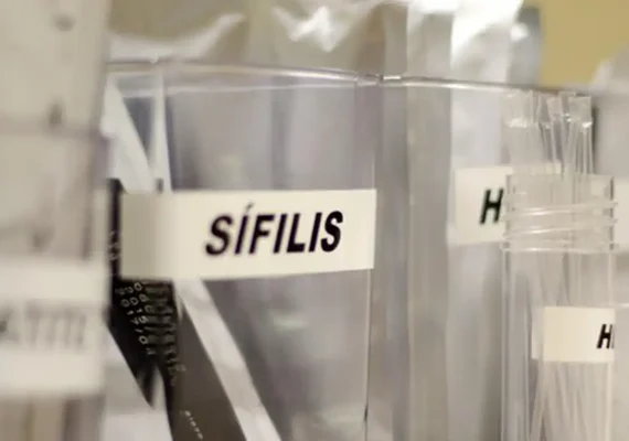 SUS passa a adotar antibiótico para prevenir sífilis e clamídia