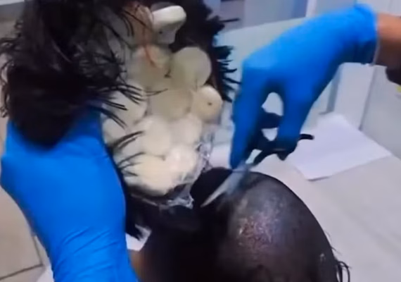 Vídeo: colombiano tenta levar drogas a Amsterdã escondidas na peruca