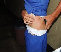 MPAL irá investigar denúncias de tortura em presídios de Alagoas
