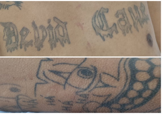 Vítima de agressão procura por familiares em Arapiraca