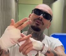 Streamer perde dedo após acidente durante tentativa de acesso ao Rock in Rio