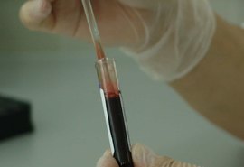 Brasil testará tratamento com plasma sanguíneo em pacientes com Coronavírus