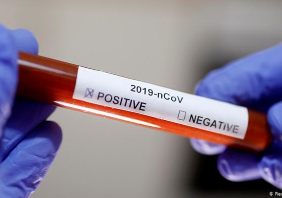 Relatório aponta aumento de 35% de infectados em Alagoas na última semana