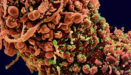 Terapia de anticorpos contra Covid-19 inicia testes entre junho e setembro