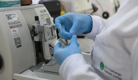 Cura do câncer de próstata pode alcançar 98%, aponta especialista da Sociedade Brasileira de Urologia