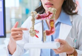 Câncer colorretal: informação e prevenção são aliados no diagnóstico precoce