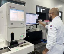 HGE passa a contar com novo equipamento capaz de realizar 100 hemogramas por hora