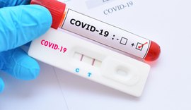 Alagoas passa de 40 mil casos confirmados da Covid-19