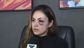 'Tinha medo dele, mas não imaginava violência', diz mulher espancada por colega