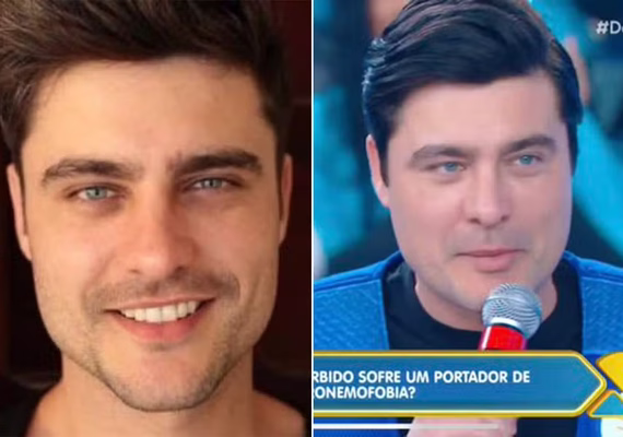 Ex galã da Globo chama atenção na web: 'Desarmonização'